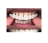 (The Baby Tooth Under, One size) New Snap On Smile Dental False Teeth Cover Perfect Smile Veneers Comfort Fit Flex Denture Teeth