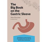 The BIG Book on the Gastric Sleeve: Everything You Need To Know To Lose Weight and Live Well with the Vertical Sleeve Gastrectomy: Volume 2 (The BIG books on Weight Loss Surgery)