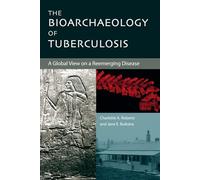 The Bioarchaeology of Tuberculosis: A Global View on a Reemerging Disease