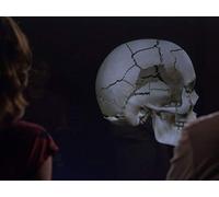 The Bullet in the Brain