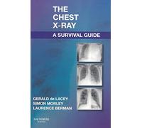 The Chest X-Ray: A Survival Guide