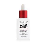 The Crème Shop Korean Skin Care What Acne? Hydrating & Healing Vitamin C Serum for Acne Treatment, Dull Skin, Irritation, Restoring, Calming, Pore Tightening