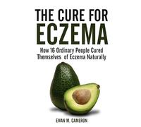 The Cure for Eczema - Hardback NEW Cameron, Ewan M 18/07/2017