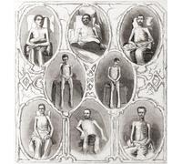 The deplorable physical state of eight Union soldiers after being released from a Confederate prison towards the end of the American Civil War. Roughly 25 000 Union soldiers died in Confederate