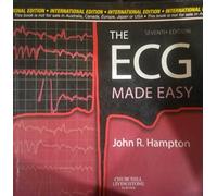 The ECG Made Easy