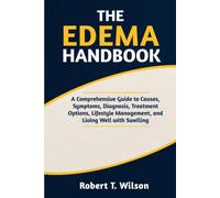 THE EDEMA HANDBOOK: A Comprehensive Guide to Causes, Symptoms, Diagnosis, Treatment Options, Lifestyle Management, and Living Well with Swelling