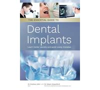 The Essential Guide to Dental Implants: Learn Insider Secrets and Avoid Costly Mistakes