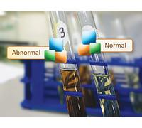 The Girl Who Turned Yellow