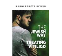 The Jewish Way of Treating Vitiligo
