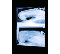 THE LEGAL SANCTITY OF MARRIAGE - PARTS 11 <> 12: WHAT'S IN A BRUISE?