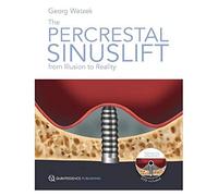 The Percrestal Sinuslift: From Illusion to Reality