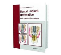 The Restoration of Dental Implants with Fixed Prosthesis