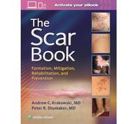 The Scar Book: Formation, Mitigation, Rehabilitation and Prevention
