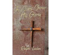 The Scars Show His Glory