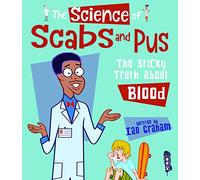 The Science Of Scabs & Pus: The Slimy Truth About Blood