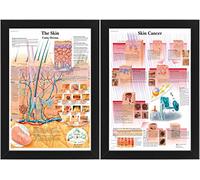 The Skin & Skin Cancer - Human Body Anatomical System, Educational Medical Posters, Professional Wall Charts, Labeled Diagrams Display (Unframed, A3)