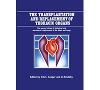 The Transplantation and Replacement of Thoracic Organs: The Present Status of Biological and Mechanical Replacement of the Heart and Lungs