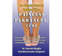 The ultimate guide for varicose veins : tips for prevention, home remedies and best treatment options