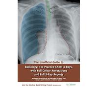 The Unofficial Guide to Radiology: 100 Practice Chest X Rays with Full Colour Annotations and Full X Ray Reports (Unofficial Guides)