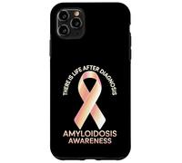 There Is Life After Diagnosis Amyloidosis Awareness - Case for iPhone 11 Pro Max