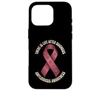 There Is Life After Diagnosis Amyloidosis Awareness Case for iPhone 16 Pro