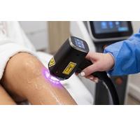 Three Laser Hair-Removal Sessions on One Small Area