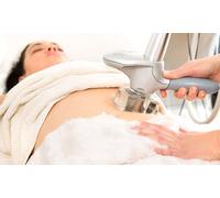 Three laser lipolysis treatments on two areas; new customers only