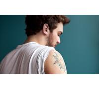 Three sessions, laser tattoo removal on a 8cm x 8cm area
