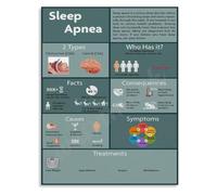 Throat Anatomy Poster Sleep Apnea Risk Factors Identification