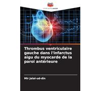 Thrombus ventriculaire gauche dans l'infarctus aigu du myocarde de la paroi antérieure