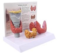 Thyroid Anatomy Model - Thyroid Nodule Model,3:1 Showing The Thyroid Pathological Digestive System Display Study Human Body Anatomical Model Teaching Tool