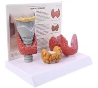 Thyroid Anatomy Model, Thyroid Pathological Model, Replica with Larynx and Thyroid Models for Human Anatomy and Physiology Education