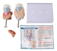 Thyroid Anatomy Model with Laryngeal Cyst Tumor for Medical Teaching and Learning Aids