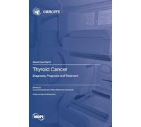 Thyroid Cancer: Diagnosis, Prognosis and Treatment