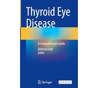 Thyroid Eye Disease: A Comprehensive Guide