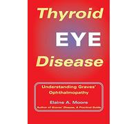 Thyroid Eye Disease: Understanding Graves' Ophthalmopathy: Understanding Graves' Opthalmopathy