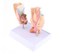 Thyroid Model, Human Normal & Pathological Anatomy Model for Endocrine Disease Education, Medical Teaching Tool, Thyroid Tumor Cyst Anatomy Study Aid