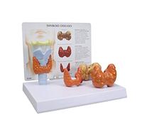 Thyroid Model Set Human Body Anatomy Replica of Thyroid Diseases Doctors Office for Educational Tool