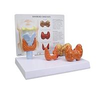 Thyroid Model Set Human Body Anatomy Replica of Thyroid Diseases Doctors Office for Educational Tool