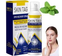 Timilk ChillErase Bump Renewal Spray, Soothing and Cooling Spray, Reduces Skin Imperfections, Natural Ingredients for Skin Tags