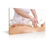 TISHIRON 1 Panels Artwork Traditional Chinese Cupping Therapy Paintings Canvas Wall Art Cupping Massage Wall Pictures Framed Wall Art Posters & Prints Stretched and Framed Ready to Hang, 16" Wx24 H