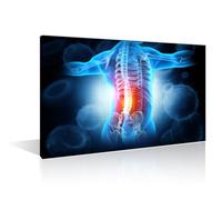 TISHIRON 1 Panels Office Decor Medical Health Care Concept Poster Wall Art for Clinic Pain in the Back Red X-Ray Pictures for Bedroom Giclee Wooden Framed Gallery-Wrapped Ready to Hang 16" Wx24 H