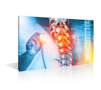 TISHIRON X-Ray Posters Wall Pictures 1 Panels Human Spine Medical Examination Framed Wall Art Clinical Laboratory Wall Art Giclee Wooden Framed Gallery-Wrapped Ready to Hang 16" Wx24 H