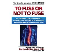 To Fuse or Not to Fuse: How Artificial Disc Replacement, Hybrid Fusion, and Fusion Alternatives are Changing the Way We Think about Spinal Fusion