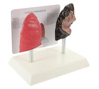 TOBBOMEY Realistic Human Lung Anatomy Model for Medical Teaching Pathological Respiratory Lung Model with Smoking Damage Display Educational Tool for Physiology and Health Schools