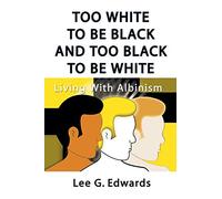 Too White to be Black and too Black to be White: Living with Albinism