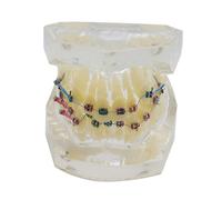 Tooth & Dental Pulp Restoration Model - Teeth Teaching Model - Typhoon Tooth Simulated Oral Tooth Teeth Demonstration Model,Orthodontic