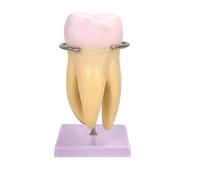 Tooth Filling Model For Teaching Resin Material Dentals Model For Dental Teaching Demonstrations