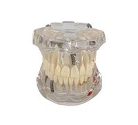 Tooth Model for Dental Learning, Movable Oral Teaching Tool | Educational Tooth Model for Dental Training, Interactive Oral Anatomy Tool for Students and Professionals