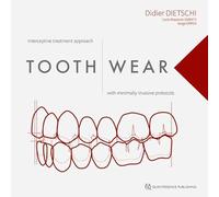 Tooth Wear: Interceptive Treatment Approach With Minimally Invasive Protocols